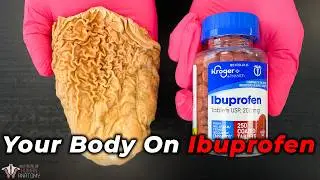 What You DON'T Know About Ibuprofen