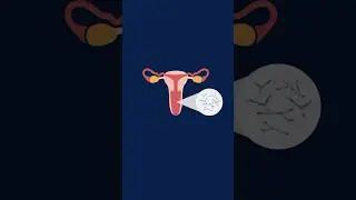 &iquest;Cu&aacute;les son los s&iacute;ntomas de la candidiasis vaginal?