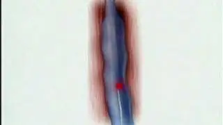 EVLT Animation