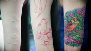 Best scar tattoo coverup advice, c-section scar and self harm scars
