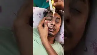 Watch Till End 🤣 Patanjali EyeDrop #funny #comedyreels #funnyreels #funny #funnyvideo
