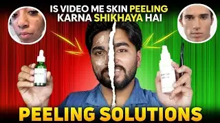 HOW To USE BODY PEELING AT HOME TUTORIAL ! REAL PEELING WITH PROOF