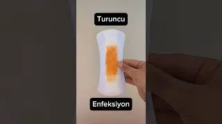 Adet kanaması renklerinin anlamları nedir ? #adetkanaması #kadinsağliği #adetkanamasırenkleri