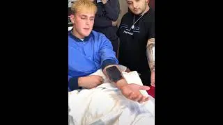 Jake Paul first YouTuber to get Vlog camera implant in his arm #shorts #jakepaul #viral