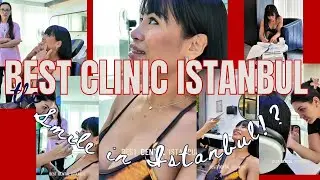 Hollywood Smile Transformation in Istanbul | Real Patient & Before-After