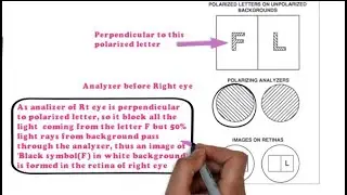Polarization Method - Polarized Targets and Polarizing Filters (Binocular Subjective Refraction) 3/4