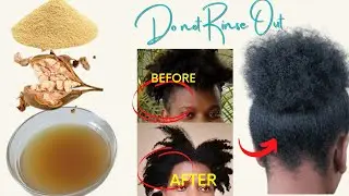 Recipe To Grow Hair And cure Hair Loss Naturally /Do Not Rinse Out/1 Week Visible Results