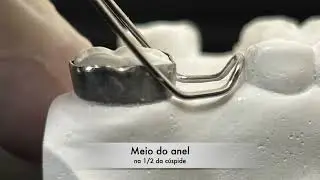 Alça e Banda. Como fazer ?