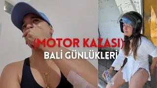 I HAD A MOTORCYCLE ACCIDENT... | Bali Diaries