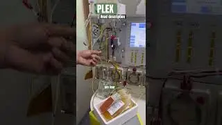 RARE PROCESS!!!! #viral #hospital #youtubeshorts #funny #doctor #science #youtube #ronaldo #messi