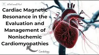 Cardiac Magnetic Resonance in the Evaluation and Management of  Nonischemic Cardiomyopathies