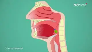 Che cosa sono la disfagia e le aspirazioni