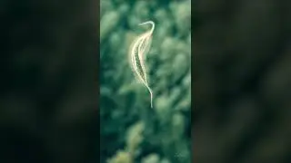 Microscopic Speedster &ndash; Paramecium in Motion