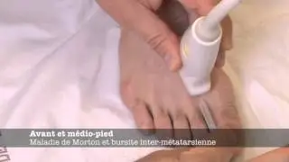 Echoms.info -  Maladie de Morton et bursite inter-métatarsienne