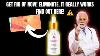 AMAROSE SKIN TAG REMOVER - ⚠️​​ALERT⚠️ - ​ AMAROSE SKIN TAG REMOVER REVIEW
