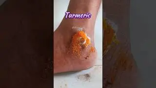 🔥Viral Video | Dark Feet Cleaning TipsX| Clean Feet Dirt & Tanning Permanently#beauty #shorts #diy