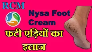 RCM foot cream || Crack heals home remedy | How to make foot soft in winters || RCM Nyasa Foot Cream
