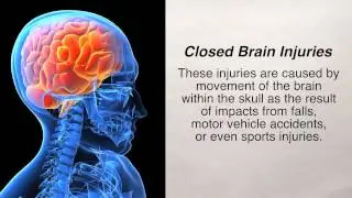2 Types of Traumatic Brain Injuries
