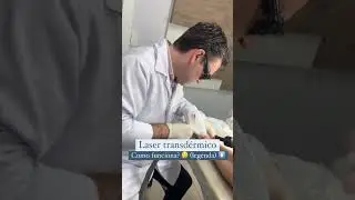 Tratamento de varizes com laser transd&eacute;rmico!