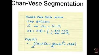Segmentation Models Demo [Snakes (Active Contours ) Chan-Vere segmentation, Geodesic active Contour]