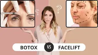 Botox vs  Facelift What You Must Know Beforehand