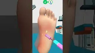 Foot Clinic - ASMR Feet Care | Android GamePlay #Shorts