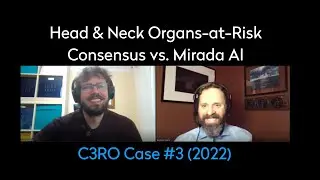 Head & Neck Organs-at-Risk: Consensus vs. Mirada