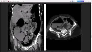TOP 3 DIFFERENTIALS RADIOLOGY