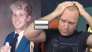 MY HAIR IS GONE? - Swifty & Chinglish Discuss Hair Loss and More (Stream Highlights)