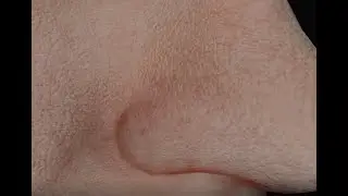 SIN - Subsurface Scattering, Realistic Skin Shading