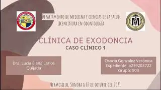 Extracci&oacute;n dental de pieza #11 Movilidad dental grado III