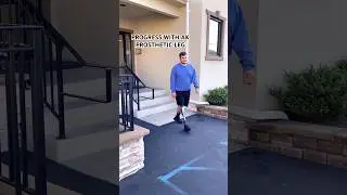 Above-Knee Amputee Progress | James Using the X4 Microprocessor Knee