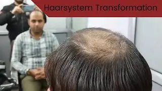 Haarsystem Transformation mit | Lordhair.de
