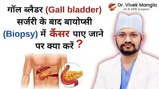Gallbladder सर्जरी के बाद Biopsy में कैंसर? अब क्या करें? | Dr. Vivek Mangla