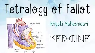 Tetralogy of Fallot |TOF| Congenital heart disease (Part2- Medicine)