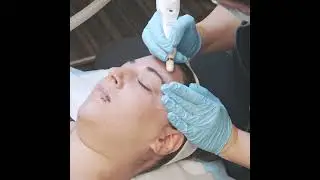 Fibroblast