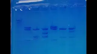 Gel Electrophoresis   Forensic DNA Analysis