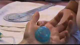 FOREARM WRIST HAND CUPPING