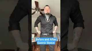 Before and After Gastric Sleeve!! 🔥