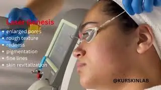 Laser Genesis | KUR Skin Lab