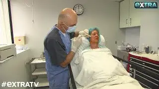 Beauty Secret! How the Stem Cell Facelift Makes You Younger