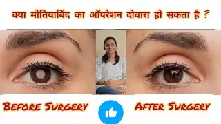 kya Cataract Surgery Fr se krwa skte hai # cataract surgery k bad dhundla kyo dikhta hai