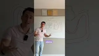 Сердечная недостаточность | Левая и правая стороны