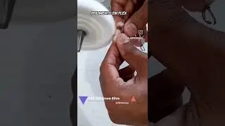 Como dou polimento em pr&oacute;tese flex&iacute;vel (FLEX)