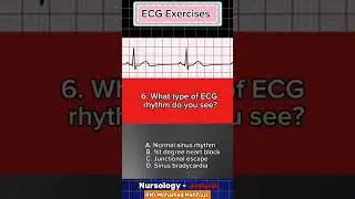 🧧ECG Exercises 🧧What the rhythm is this ..?#nurse #nursing #mexicine #medical #doctor #ecg #heart