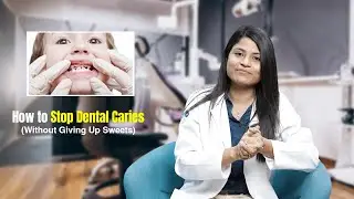 How to Prevent Cavities Without Giving Up Sweets!
