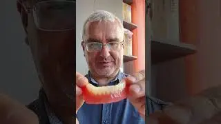 Despre proteza cu magneți/capse