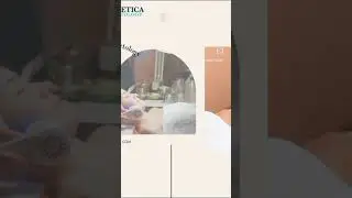 Body Treatment(Hair Removal, Acne treament, Laser Treatment )