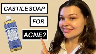 Castile soap for the face?: why it's a really bad idea.