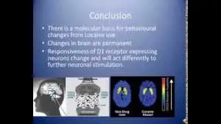 Cocaine Dopamine D1 Receptor Gene expression changes